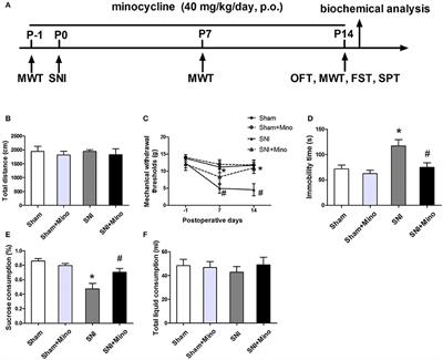 Spared Nerve Injury Increases the Expression of Microglia M1 Markers in the Prefrontal Cortex of Rats and Provokes Depression-Like Behaviors